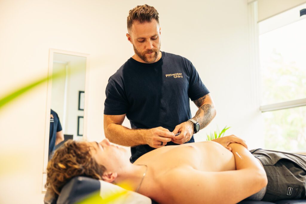 A male chiropractor using dry needling to treat a patient's muscle spasm from low back pain